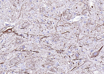 NF-L antibody