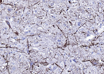 NF-L antibody