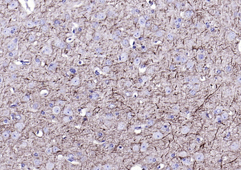 NF-L antibody