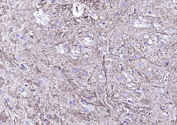 NF-L antibody