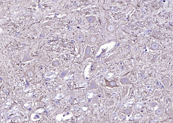 NF-L antibody