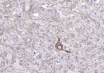 NF-L antibody