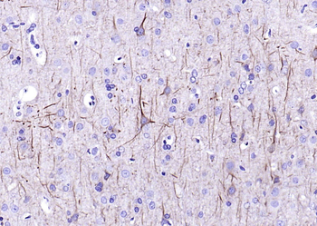 NF-L antibody