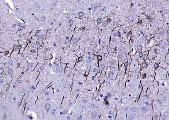 NF-L antibody