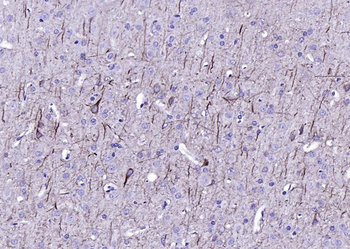 NF-L antibody