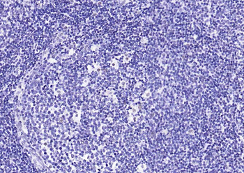 MRE11 antibody