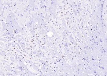 MRE11 antibody