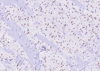 MRE11 antibody