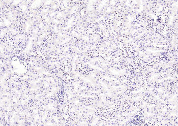 MRE11 antibody