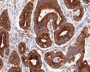 TGF alpha antibody