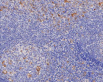 TGF alpha antibody