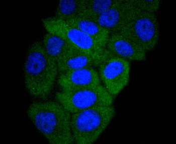 GART antibody