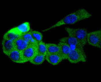 GART antibody