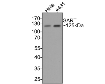 GART antibody