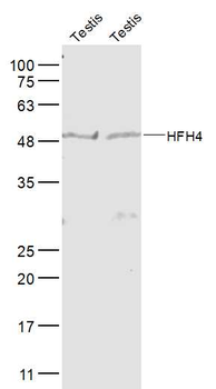 FOXJ1 antibody