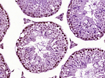 FOXJ1 antibody