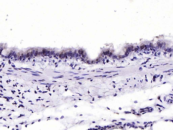 FOXJ1 antibody