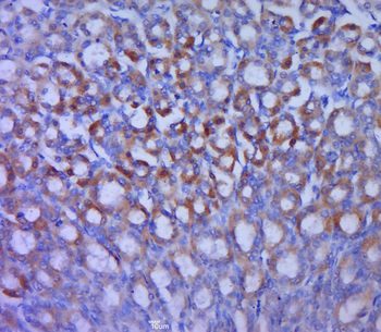 GLUT12 antibody