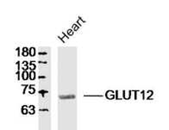 GLUT12 antibody