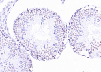 Histone 2AX antibody