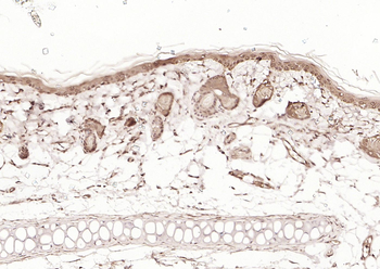 HDAC2 antibody