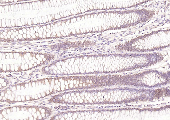 HDAC2 antibody