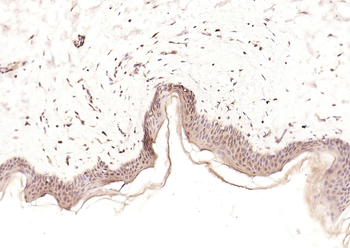 HDAC2 antibody