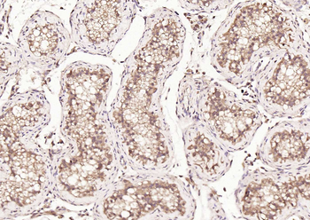 HDAC2 antibody