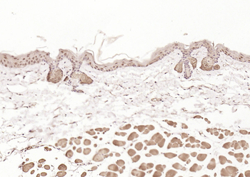 HDAC2 antibody