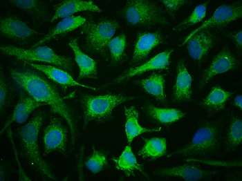 JAK2 (phospho-Tyr1007/1008) antibody