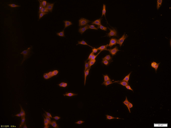 JAK2 (phospho-Tyr1007/1008) antibody