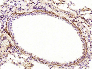 JAK2 (phospho-Tyr1007/1008) antibody