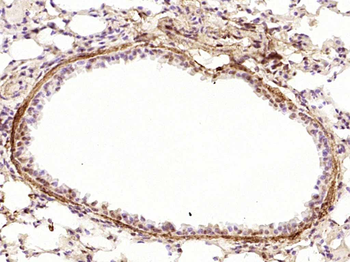 JAK2 (phospho-Tyr1007/1008) antibody