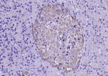 LDHA Rabbit Polyclonal Antibody
