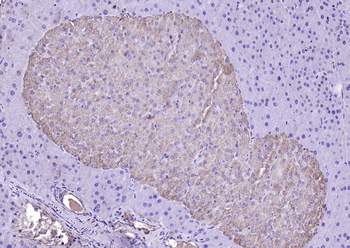 LDHA Rabbit Polyclonal Antibody