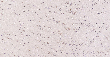 MMP12 antibody