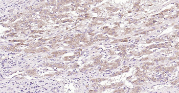 MMP12 antibody