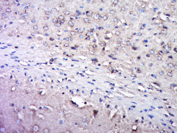 GLUR2 antibody