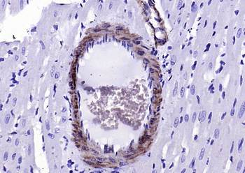 SM22 alpha antibody