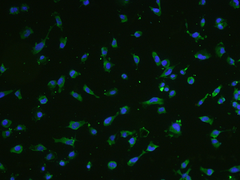 SM22 alpha antibody