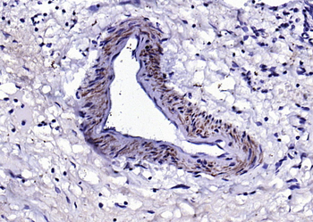 SM22 alpha antibody