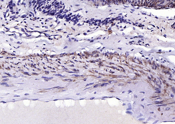 SM22 alpha antibody