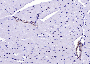 SM22 alpha antibody