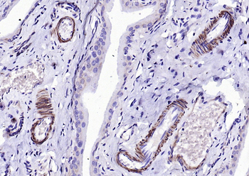 SM22 alpha antibody