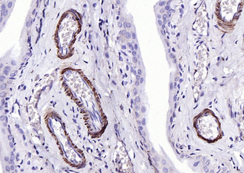 SM22 alpha antibody