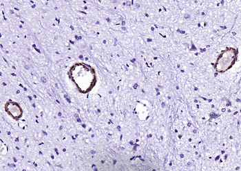 SM22 alpha antibody