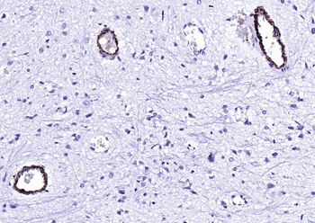 SM22 alpha antibody