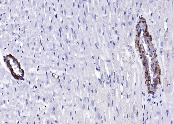 SM22 alpha antibody