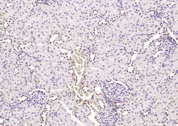 pSRF antibody