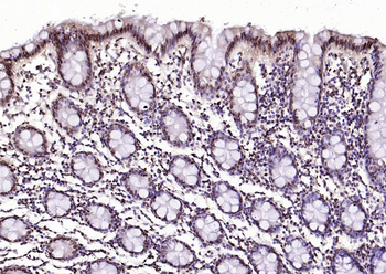 pSRF antibody